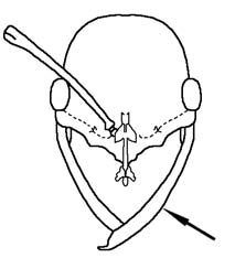 File:Heterick 2009 Fig 081.jpg