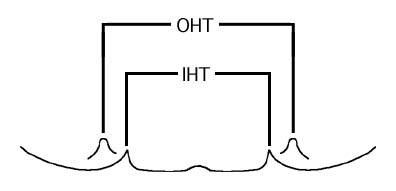 Pheidole character hypoteeth.jpg